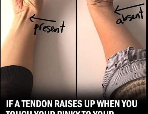 Hidden in Plain Sight: What the Tendon in Your Wrist Reveals About Evolution