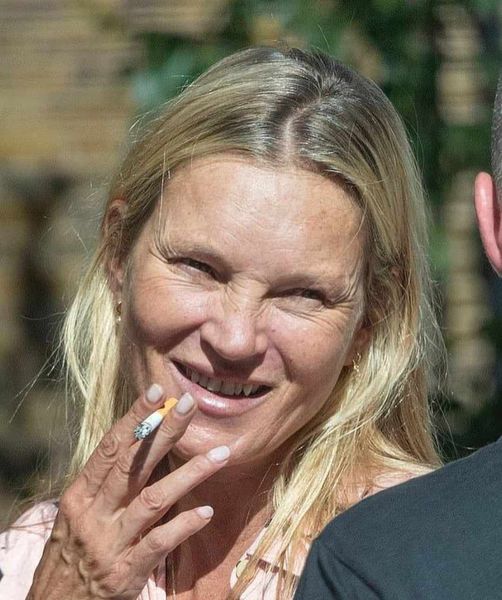 Kate Moss, 49, Unrecognizable in Recent Photos: Deep Wrinkles and Damaged Teeth Spark Shock