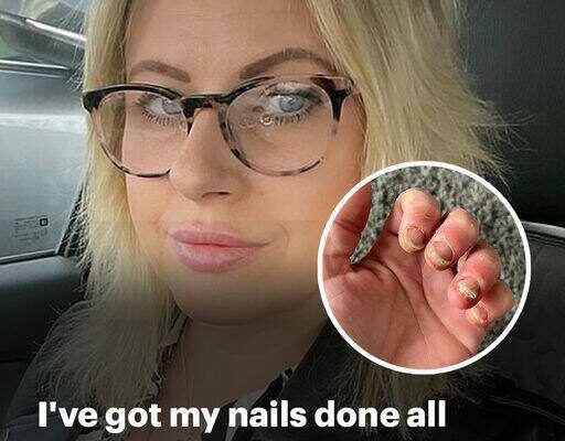 Woman Struggles to Use Her Hands After Years of Gel Manicures!