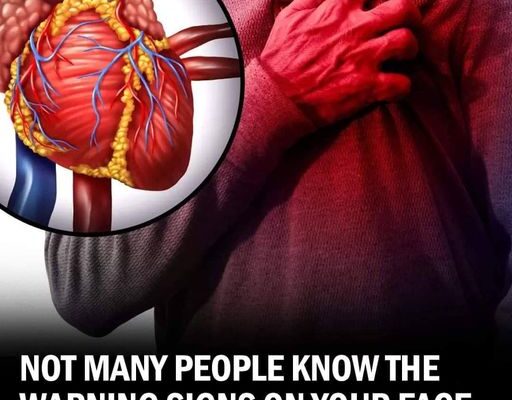 Facial Indicators That Could Signal Heart Trouble