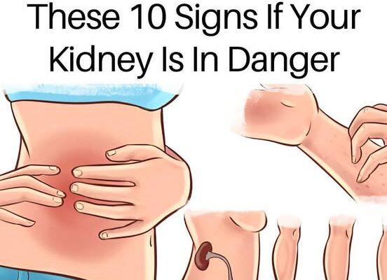 If Your Kidneys Are in Danger, the Body Will Show these 10 Signs