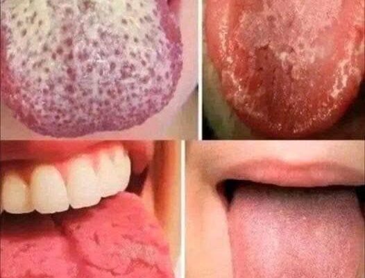 If you’re experiencing these four tongue symptoms, they could indicate underlying health conditions.