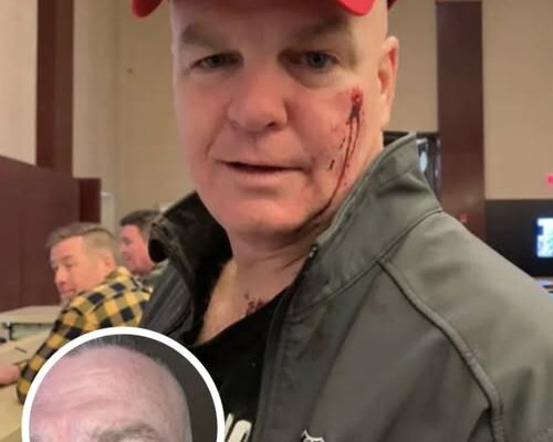 Woman Punches Retired NYPD Detective Because Of His ‘Birthday Hat’