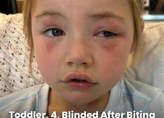 Mom’s warning after detergent pod blinds 4-year-old girl