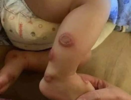 ALERT: These are the signs that it is cre…See more