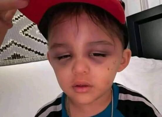 A 3-year-old boy …
