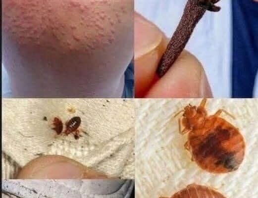 Young woman dies at the hands of her…See moreIt was itching his body, he thought it was an allergy, but a tough diagnosis… See more