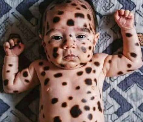 Mom shocked by her baby after birth, her words now spread like forest fire!
