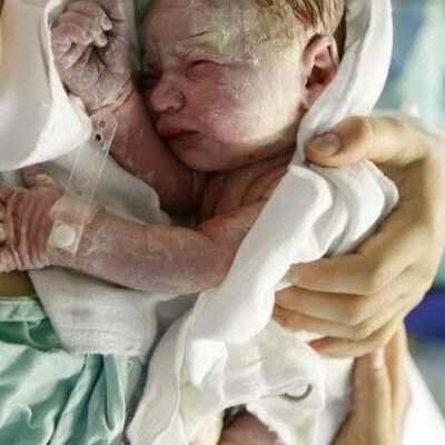 Baby born with an DIU peg… See more