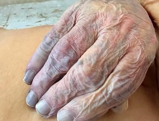 Women who have hands… see more