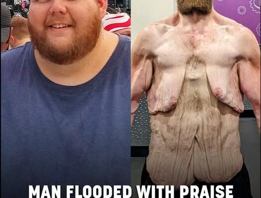 Internet praises man for 360lb weight loss