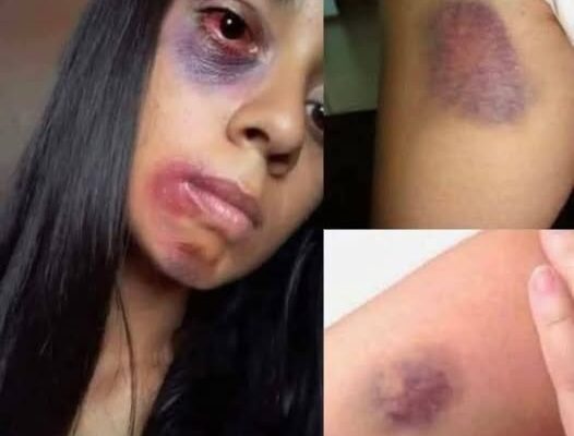 Young woman dies at the hands of her…See more