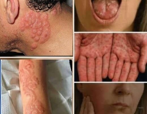 HT1. Symptoms You Should Never Ignore: What They Might Be Telling You
