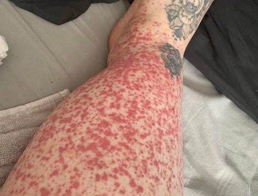 These are the consequences of sleeping with…See more