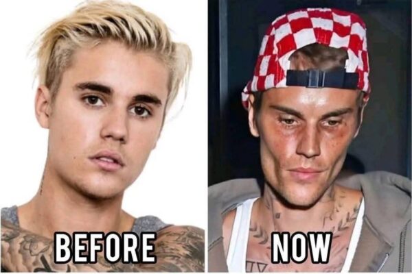 Justin Bieber admits that he tested positive for…See More