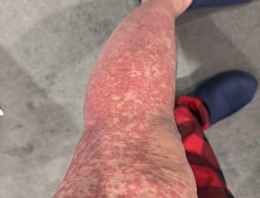 These are the consequences of sleeping with…