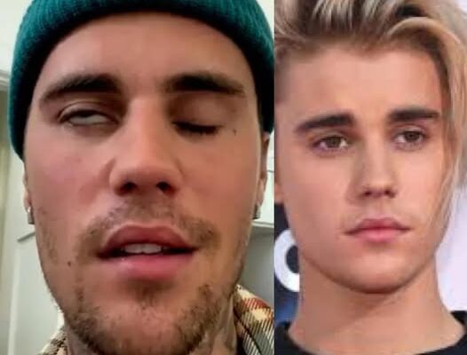 Justin Bieber admits that he tested positive for…