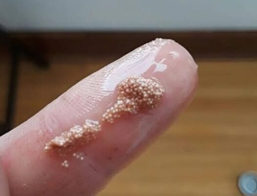 White bits in the egg: what are they really and should you be worried?