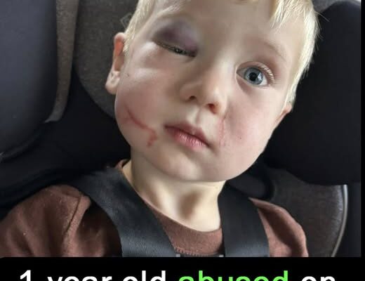 Daycare worker arrested after toddler arrives with black eye and swollen face on first day