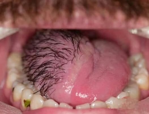 HT15. These Are The Consequences Of Eating Cr… See More