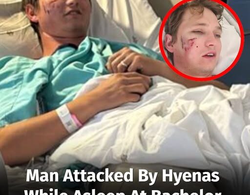 Man Attacked By Hyenas While Asleep At Bachelor Party Survived Thanks To Two Quick Actions