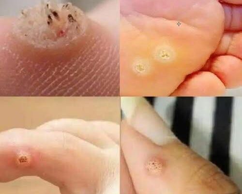 😲‼️To BE VERY CAREFUL . If you get this, you are infected with …