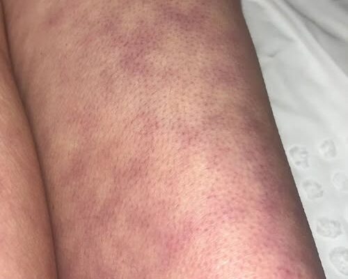 What those strange skin patterns might really mean