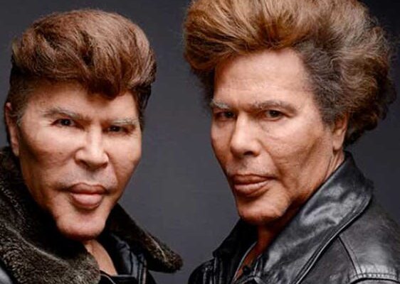 🤯Due to numerous plastic surgeries, these brothers have severely altered their appearance. 😓What did they look like before?