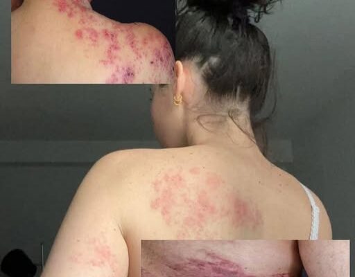 These are the consequences of sleeping with your c… See more