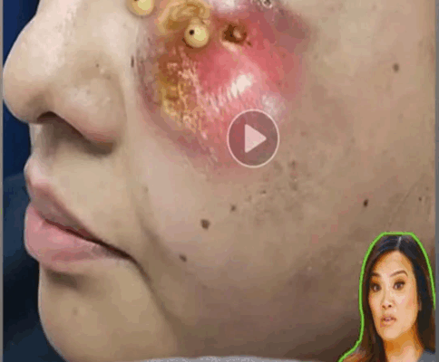 ST. 10 Early Signs of Health Problems You Shouldn’t Ignore