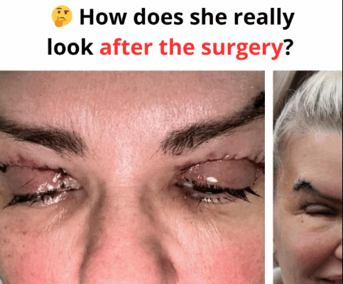 ST. Kerry Katona’s Bold Transformation: The Pop Star Who Isn’t Afraid to Change Her Face and Her Life