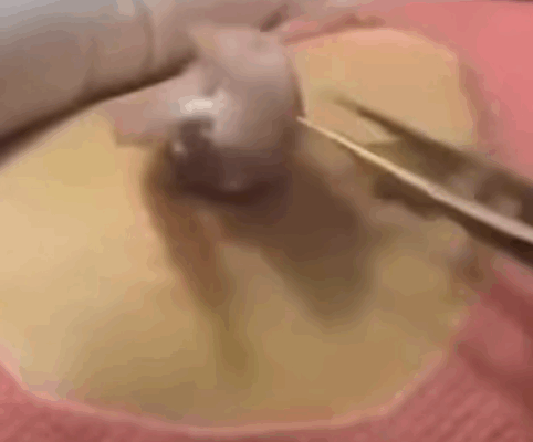 ST.6 Alarming Effects of Sleeping Less Than 7 Hours a Night, According to Recent Studies