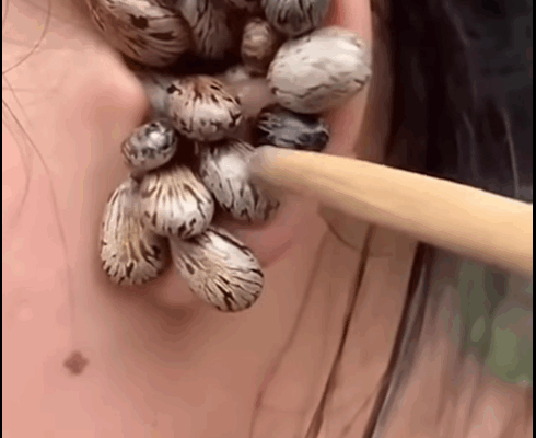 ST. 5 Alarming Ways Your Body Might Be Signaling Health Problems