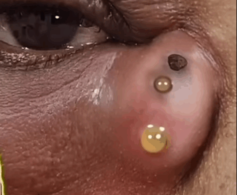 ST. 12 Unusual Eye Changes That Might Predict Serious Health Issues