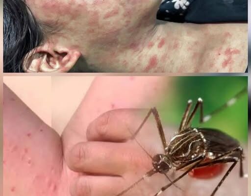 🚨 ALERT: New Disease Outbreak in China — Over 7,000 Cases Reported, Symptoms and Risks Revealed…see more